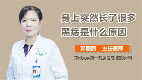 身上黑痣增多|最近身上长了很多黑痣怎么回事